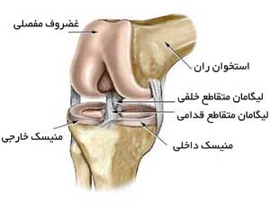 پیوند از تاندون کشکک