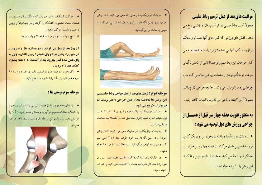  عمل ترمیم رباط صلیبی